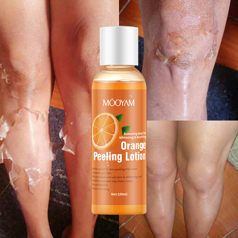 Orange Peel Lotion Peeling Oil Body Lotion Gentle Exfoliation