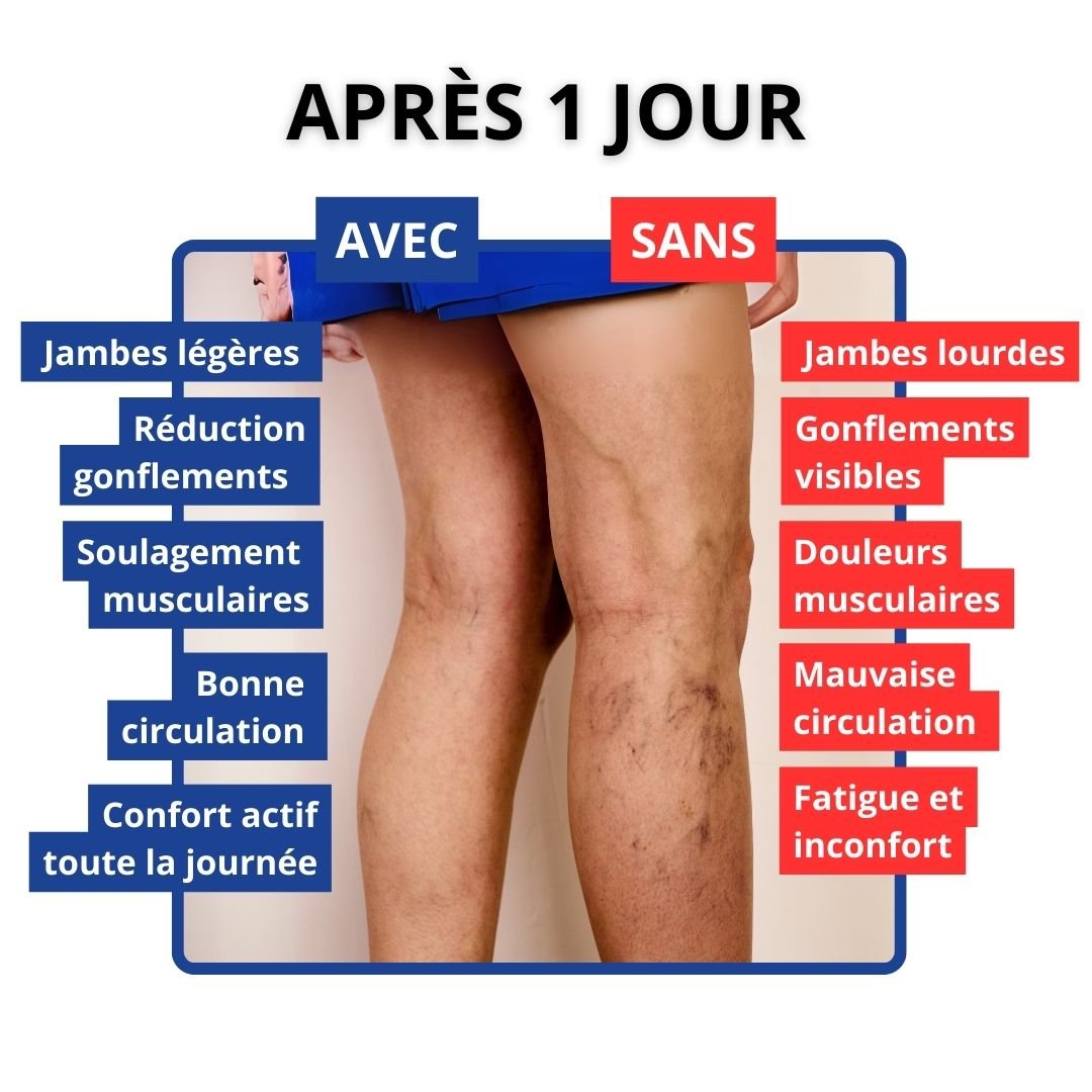 Chaussettes de contention Soulagement immédiat - VersatimsChaussettes de contention Soulagement immédiatVersatims200000384