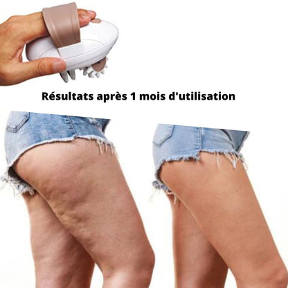 Masseur 3D Anti cellulite électrique - VersatimsMasseur 3D Anti cellulite électriqueVersatims