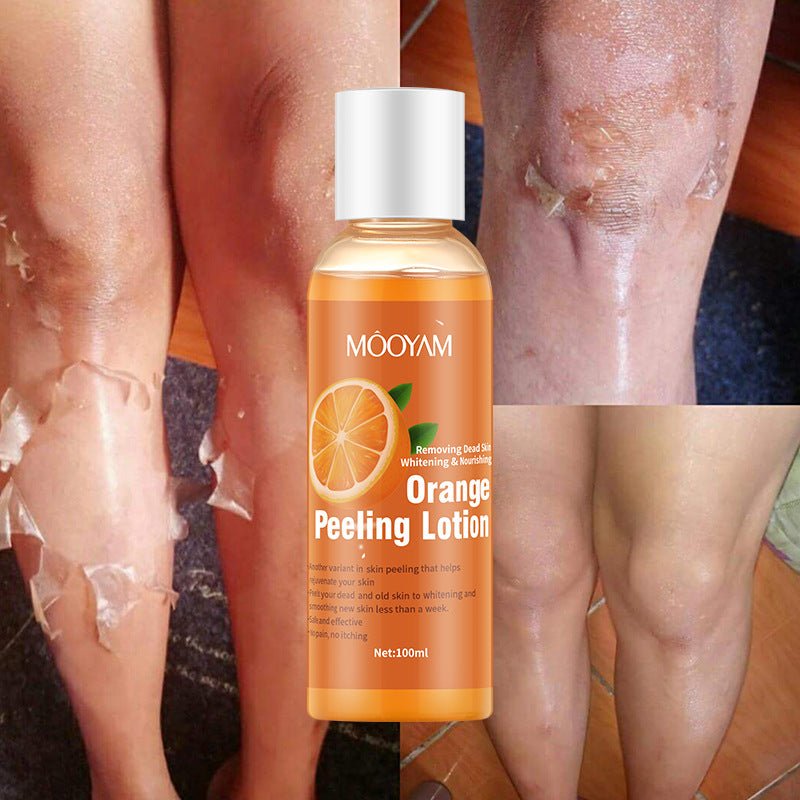 Orange Peel Lotion Peeling Oil Body Lotion Gentle Exfoliation - VersatimsOrange Peel Lotion Peeling Oil Body Lotion Gentle ExfoliationVersatimscellulite